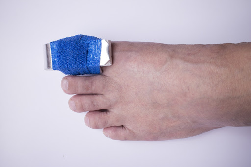 Phalanx fracture at toe with splint and elastic gauze