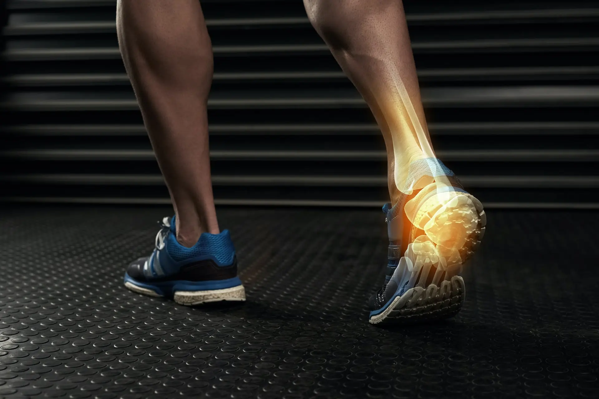 A rendering of a male runner's calves and feet, with an anatomical "cutaway" of musculature and bone.
