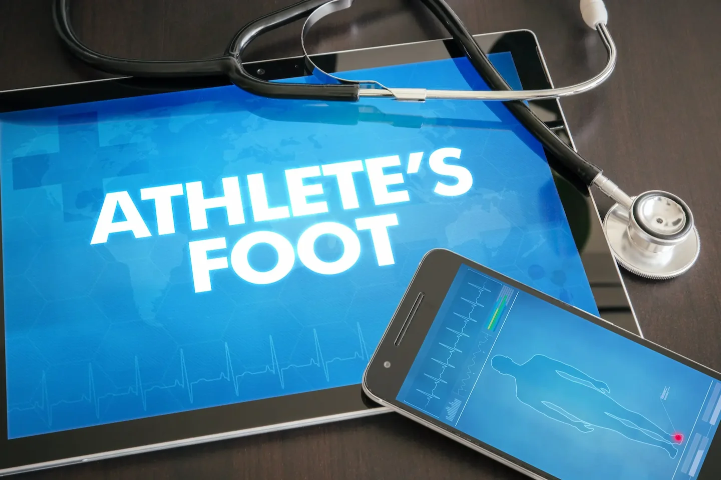 An infographic reading "Athlete's Foot".